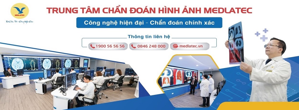 Điểm mạnh của phương pháp chụp X-quang cột sống thắt lưng De Sèze so với các phương pháp khác?
